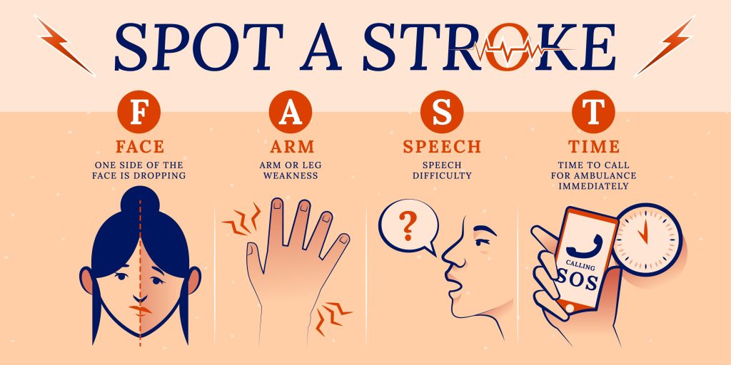 Risk for Stroke infographic