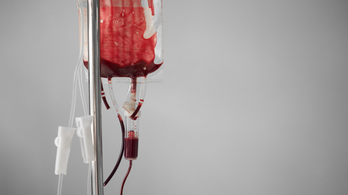 ABC Score For Massive Transfusion